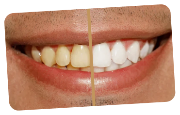 Description of image